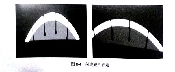 X射線檢測金剛石鋸片時出現(xiàn)的缺陷分析